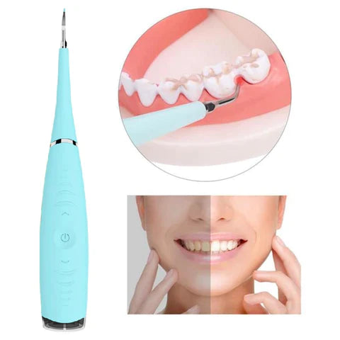 Removedor de Tártaro e Sujeiras - Dental